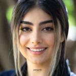 لمینت دندان چیست؟