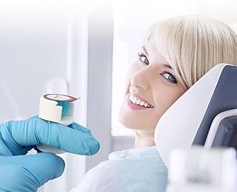 پالیش کامپوزیت | افزایش درخشندگی دندان، قیمت مناسب