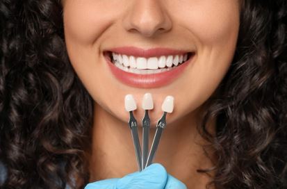 انواع روکش دندان