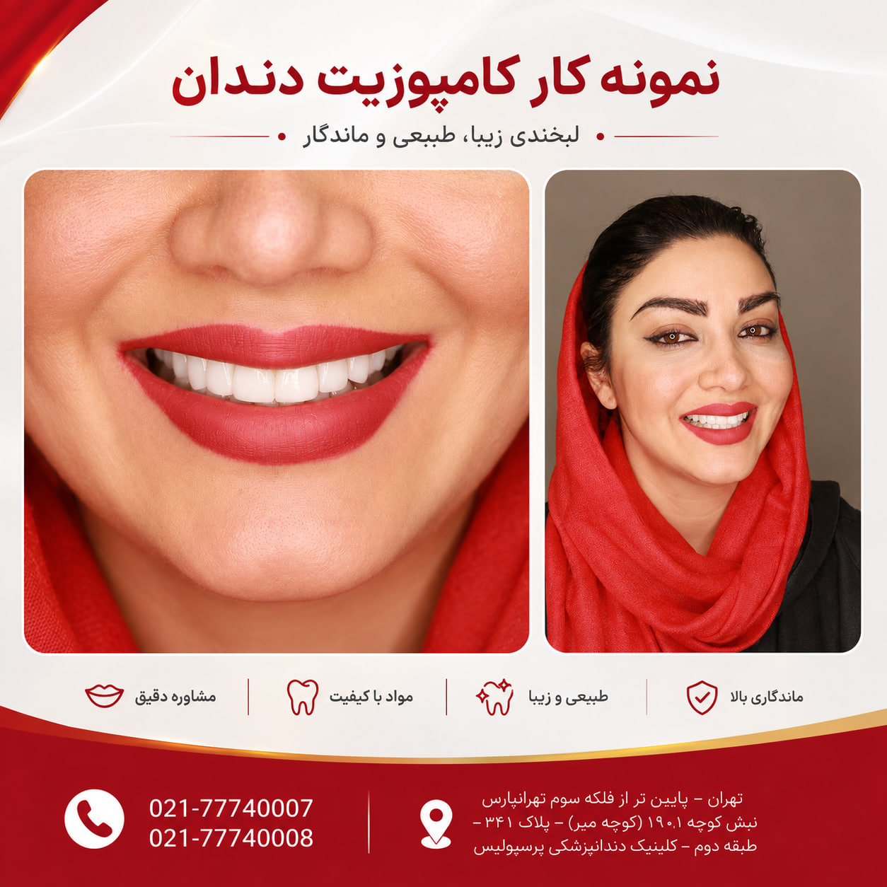 نمونه کار قبل و بعد کامپوزیت دندان