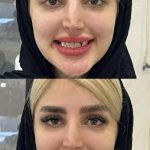 ارتودنسی دندان در فلکه سوم تهرانپارس