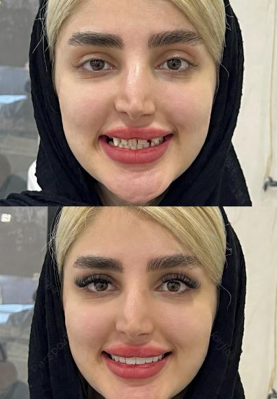 ارتودنسی دندان در فلکه سوم تهرانپارس ارتودنسی دندان در فلکه سوم تهرانپارس