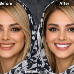 بلیچینگ دندان در فلکه سوم تهرانپارس