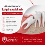 آیا همه دندان‌های عقل باید کشیده شوند؟