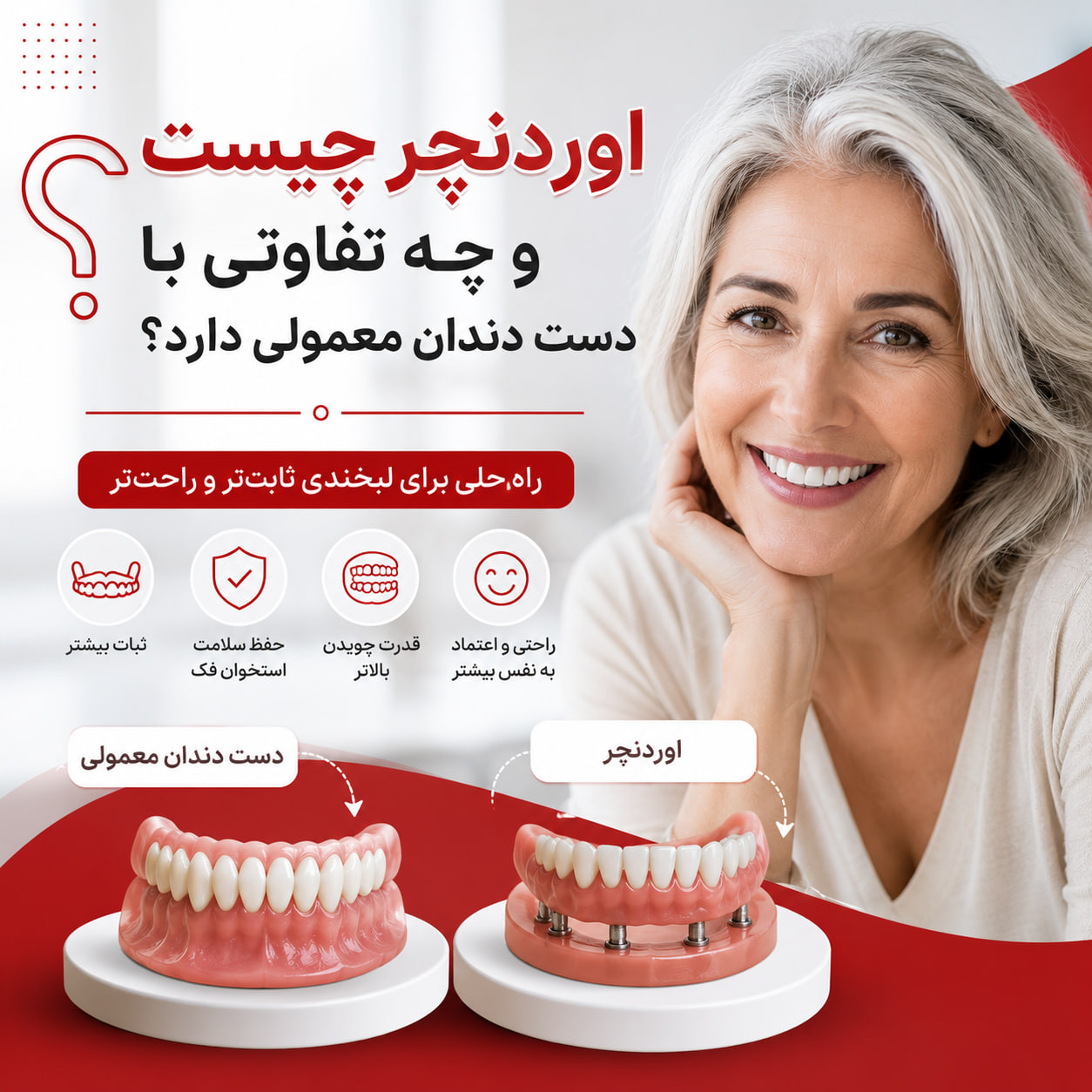 اوردنچر چیست
