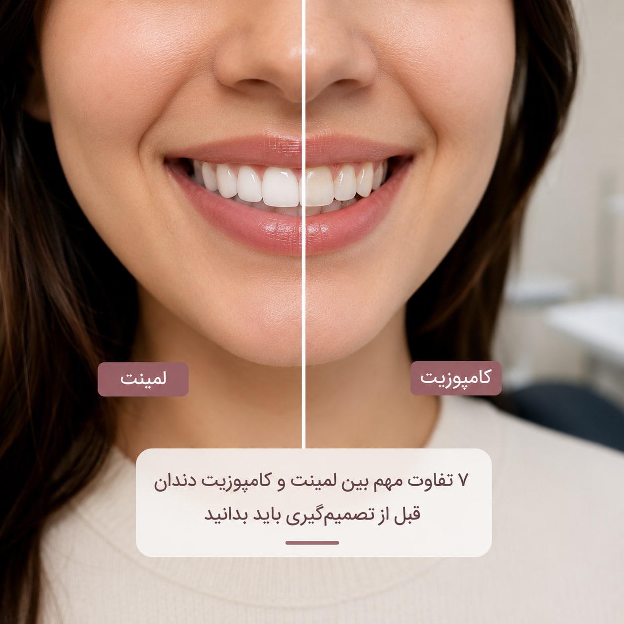 ۷ تفاوت لمینت و کامپوزیت دندان که قبل از تصمیم باید بدانید تفاوت لمینت و کامپوزیت