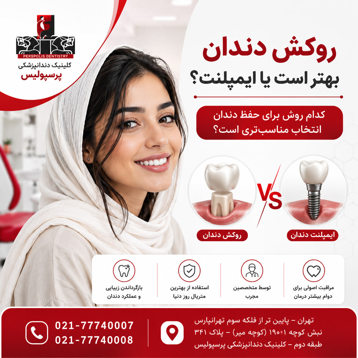 روکش دندان بهتر است یا ایمپلنت؟ روکش دندان بهتر است یا ایمپلنت؟