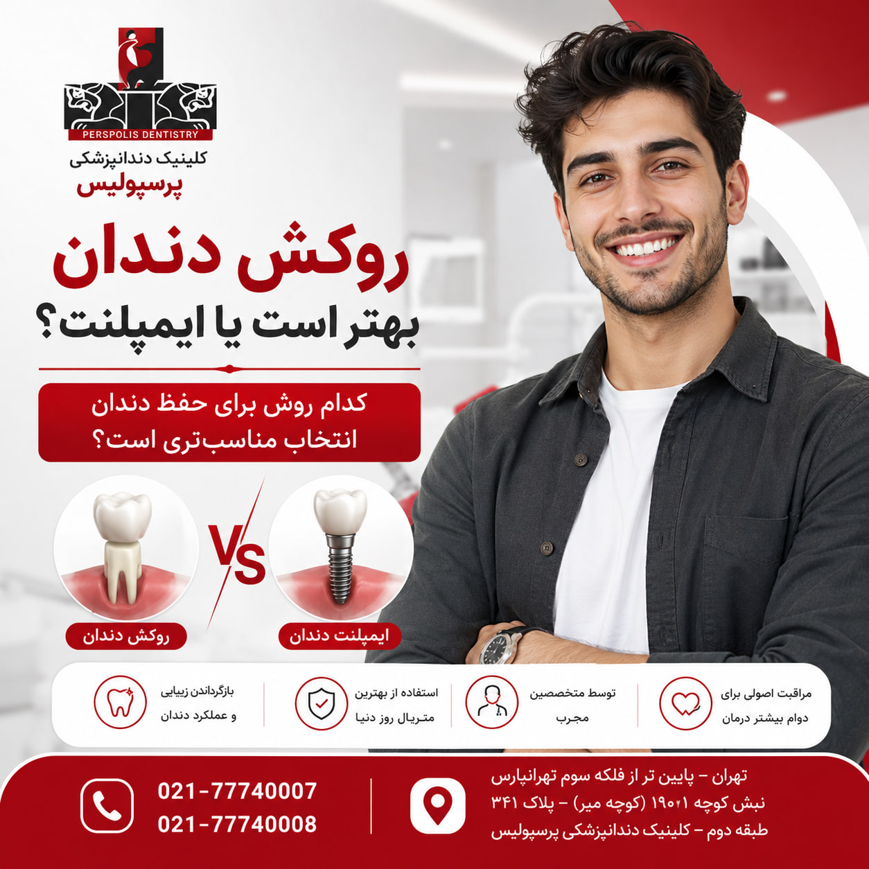 روکش دندان بهتر است یا ایمپلنت؟ روکش دندان بهتر است یا ایمپلنت؟