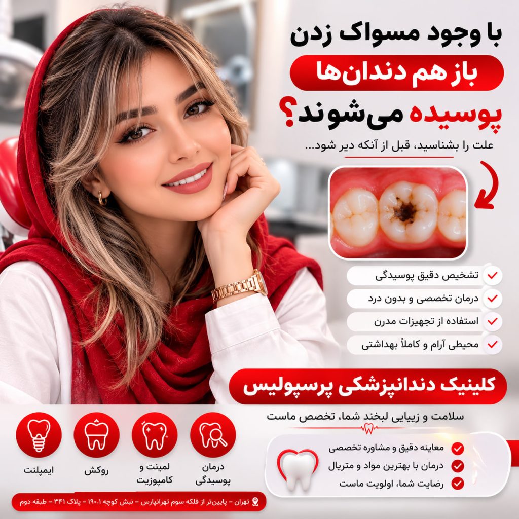 چرا با وجود مسواک زدن باز هم دندان‌ها پوسیده می‌شوند؟