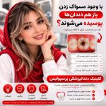 چرا با وجود مسواک زدن باز هم دندان‌ها پوسیده می‌شوند؟