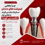 چرا بعضی ایمپلنت‌های دندان سال‌ها دوام می‌آورند؟
